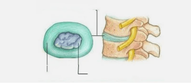 Nature of osteochondrosis