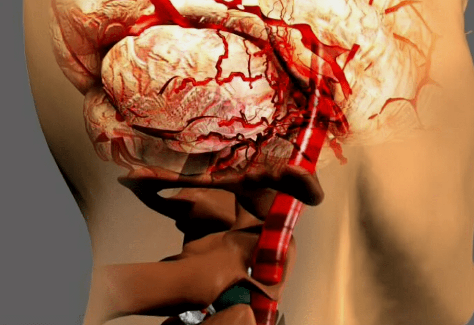 than cervical osteochondrosis is dangerous