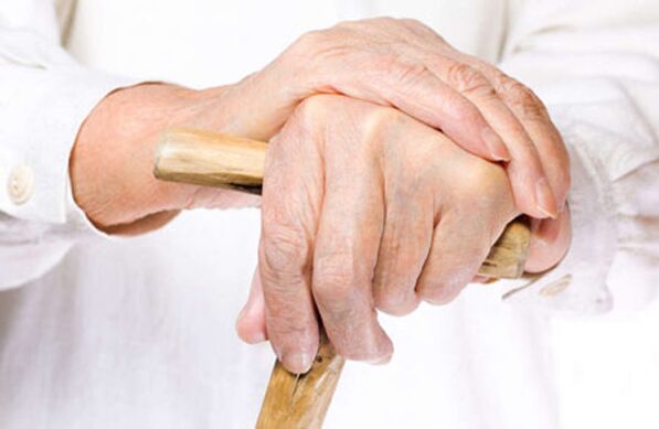arthrosis of the fingers in an elderly person